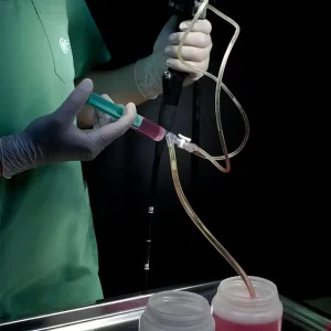 Limipieza Y amntenimiento Endoscopio